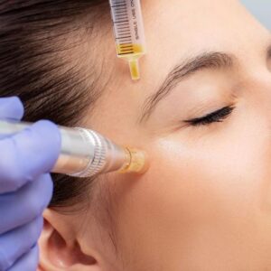 Hilos tensores mas botox molecular
