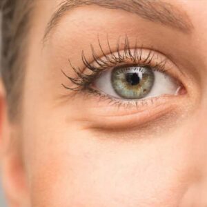 Bolsas y ojeras F-eye contour