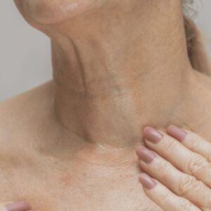 Peeling de algas cuello